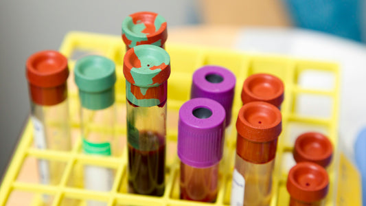 Blood sample tubes with coloured caps in a laboratory rack